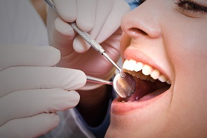 Why You Should Get A Dental Checkup?